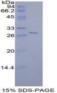 SDS-PAGE